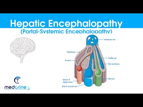 Hepatic Encephalopathy :(portal systemic encephalopathy) causes, classification, features,DX and rx