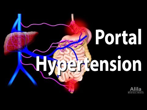 Portal Hypertension, Animation