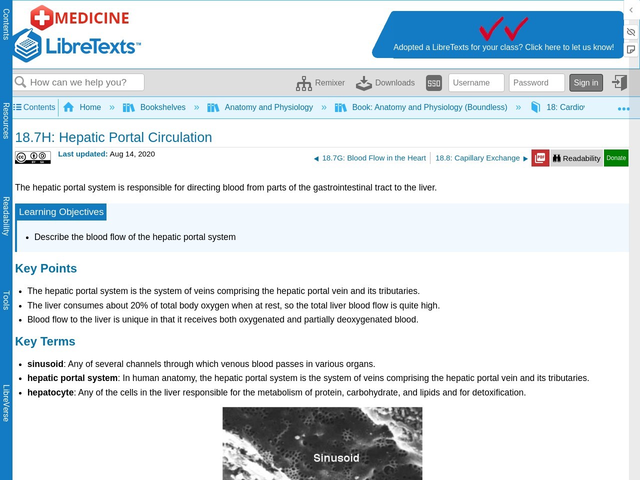 18.7H: Hepatic Portal Circulation - Medicine LibreTexts
