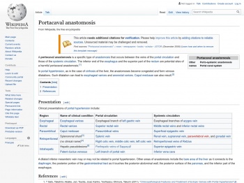 Portacaval anastomosis - Wikipedia