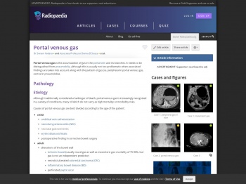 Portal venous gas | Radiology Reference Article ...